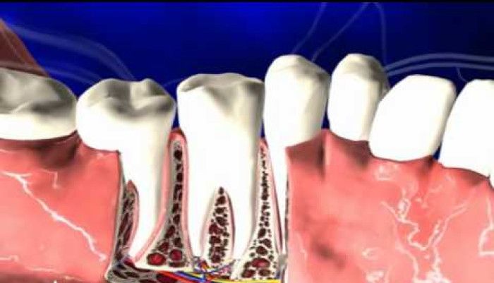 Amerra,Medical,Animation,Dental,Tooth,Dentin,Gums